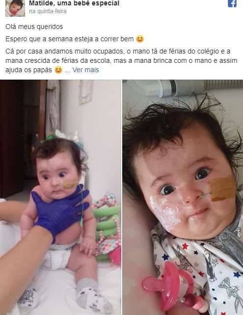 Saúde | Bebé Matilde recebe o fármaco de dois milhões esta semana