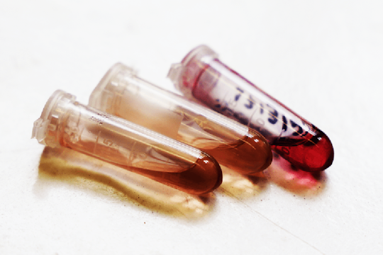 CIÊNCIA: Ouro à nanoescala tem potencial no tratamento do cancro