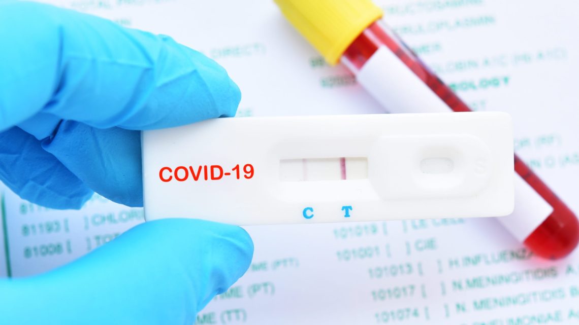 Infecções por coronavírus ultrapassam esmagadoramente os números oficiais: estudo