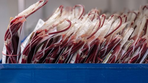 Arranca este mês a transfusão de plasma convalescente