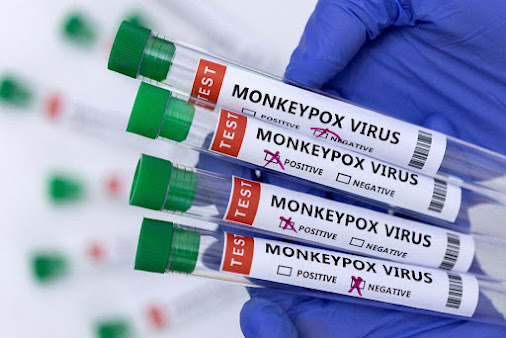 Sobe para 166 casos de varíola dos macacos em Portugal