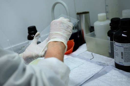 Cancro: Coimbra arranca tratamentos com células geneticamente modificadas